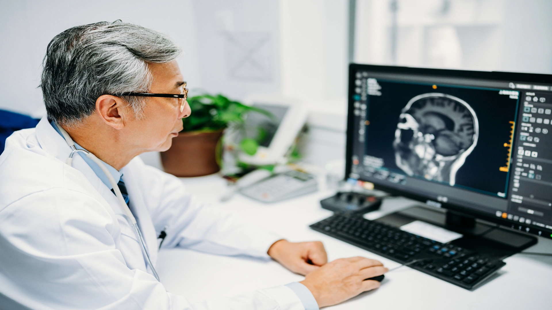 中國研究人員測試神經植入裝置 讓截肢者用意念控制游標