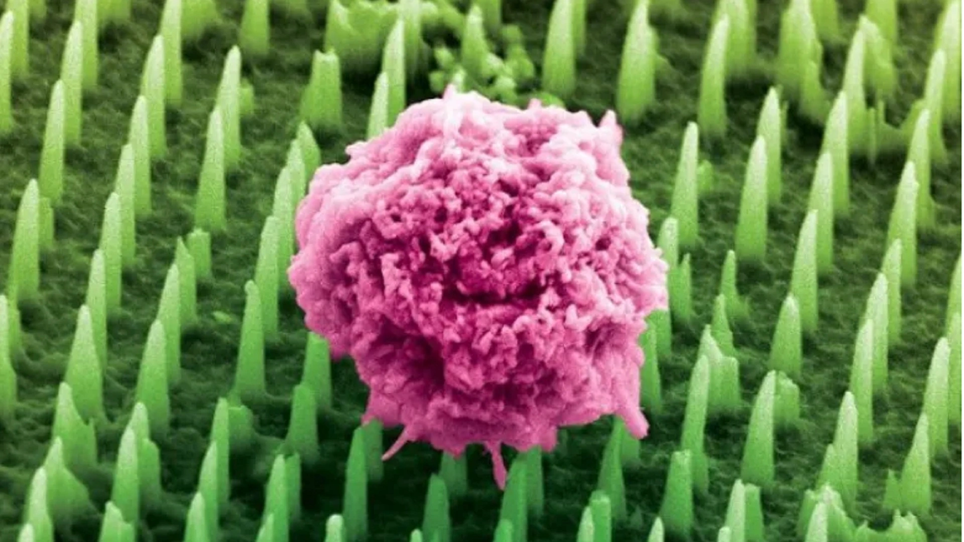 無痛生物檢測新技術：微針貼片的突破性應用