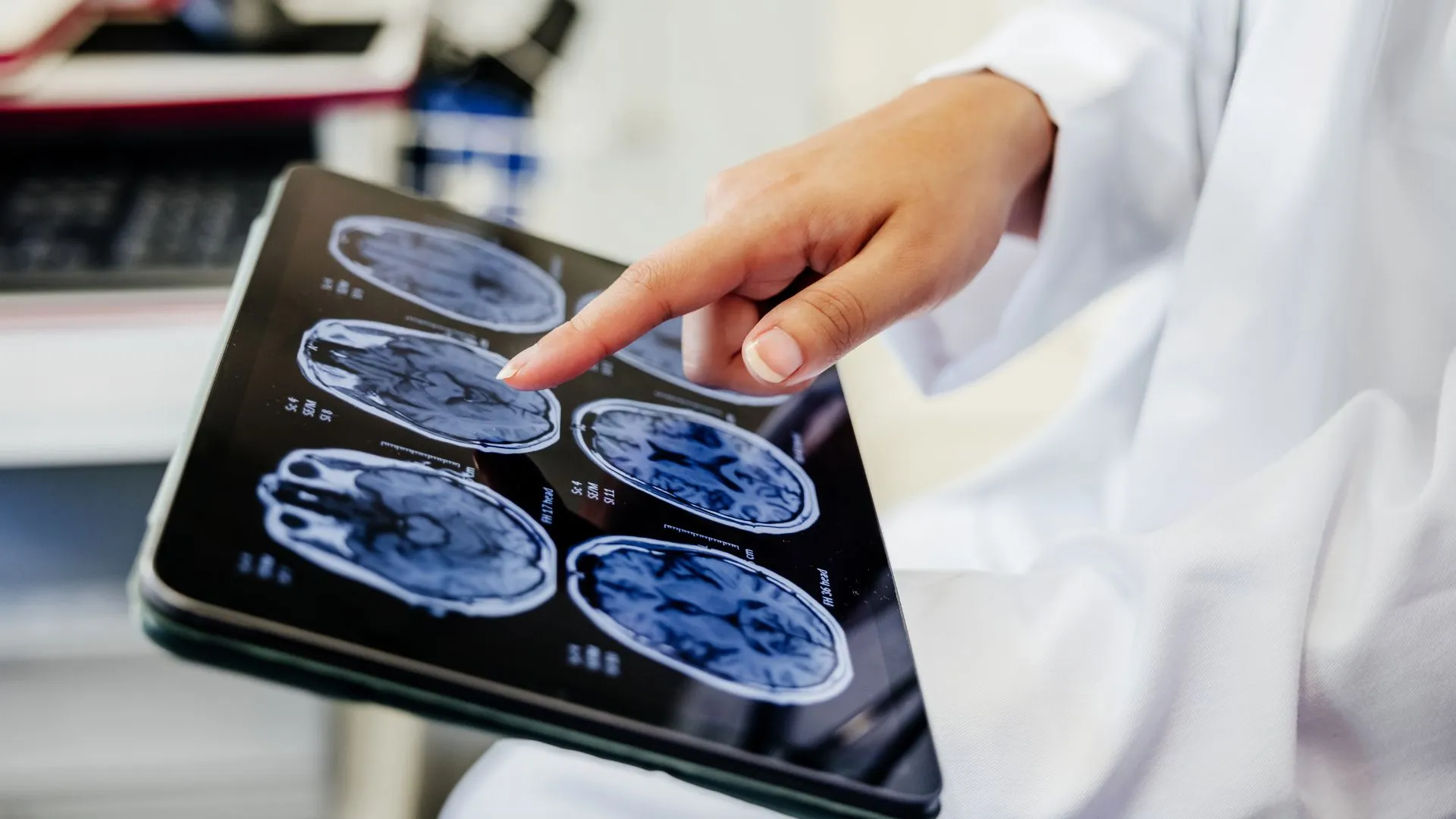 微型金屬花朵在腦部疾病治療中的潛在應用