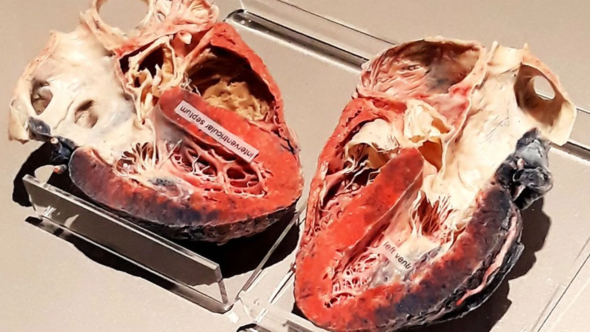 中國「離子玻璃」技術使大腦與心臟透明化