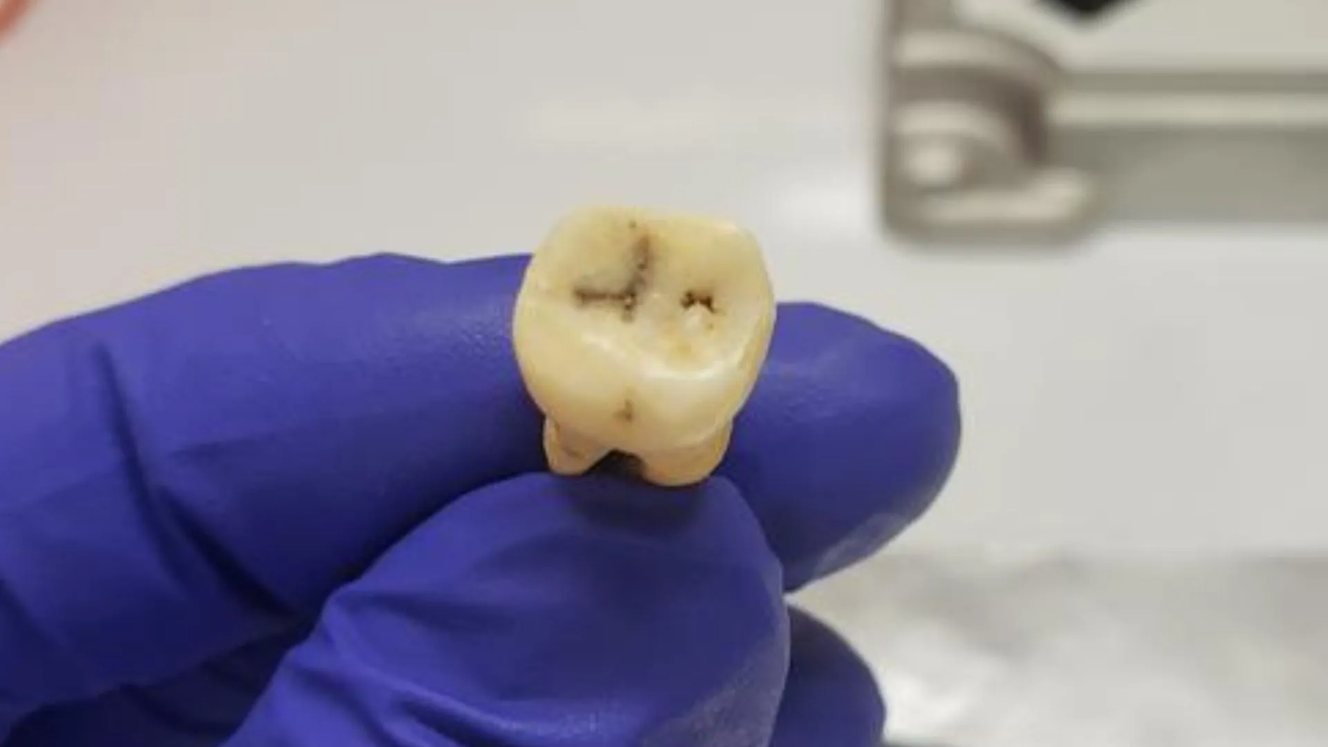 科學家確認引發「全球首場疫情」的病原體