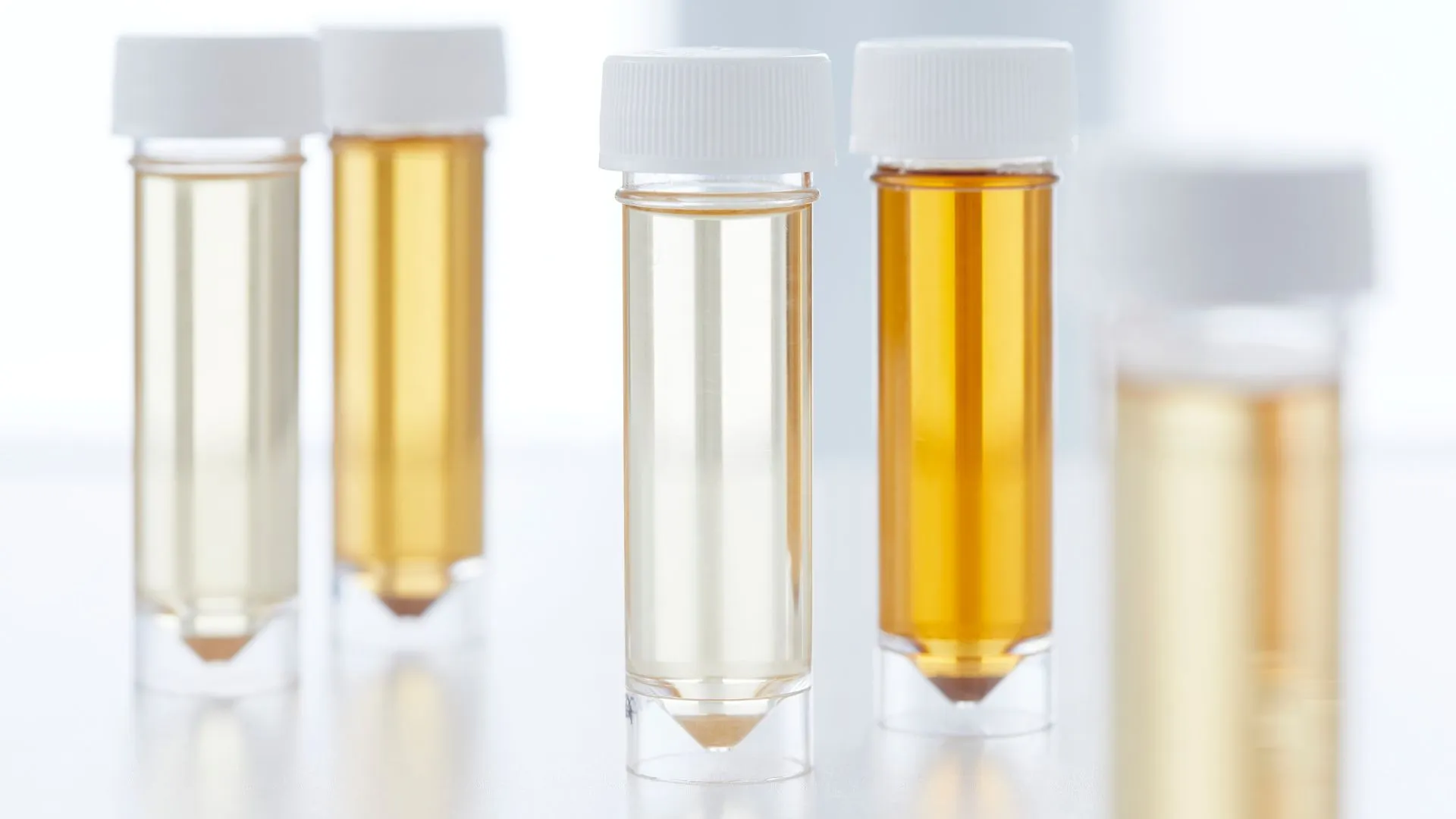 人類尿液轉化為肥料的太陽能反應器，能源提升 60%