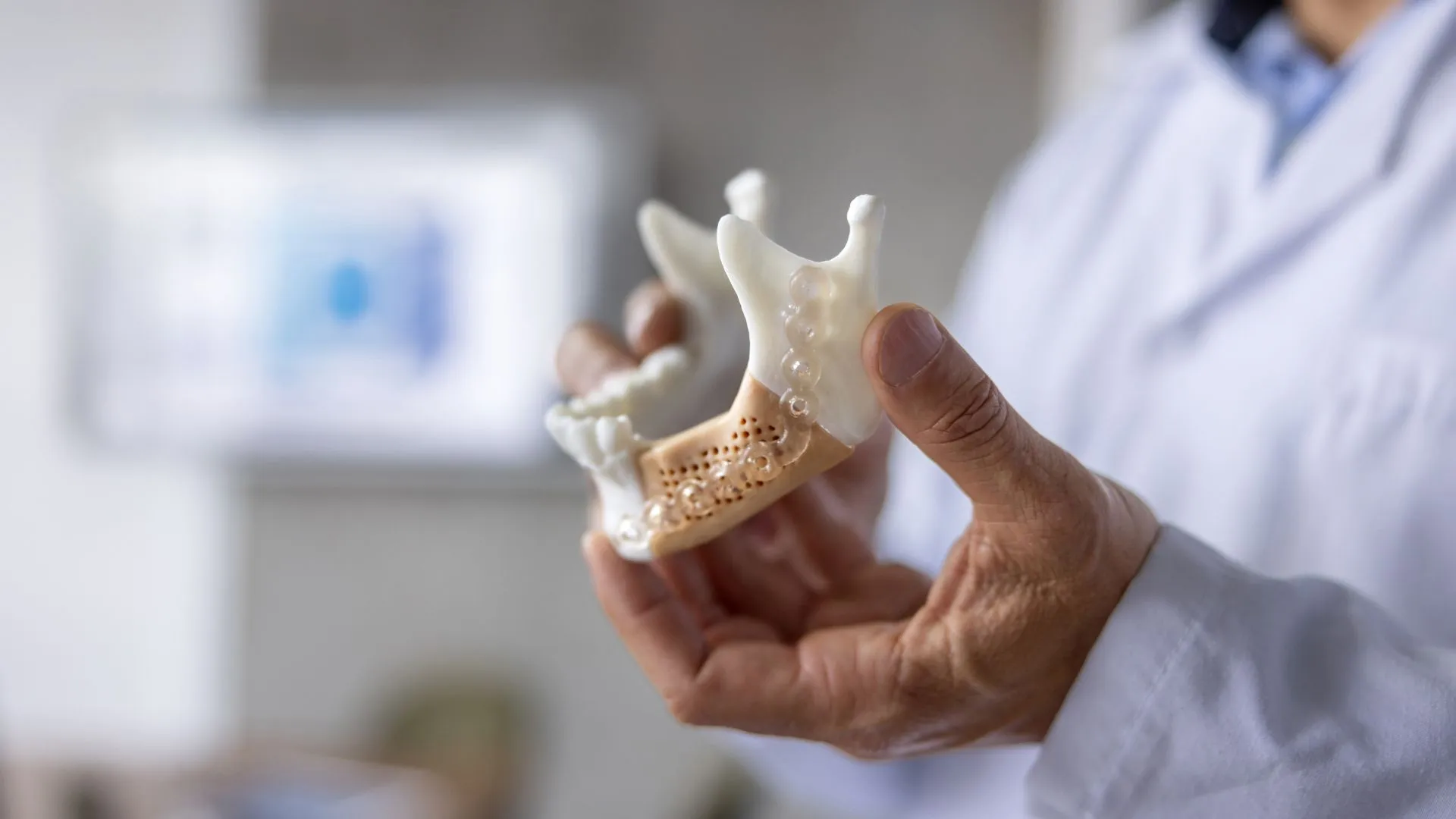 3D 可打印生物玻璃支架作為骨骼替代品的潛力