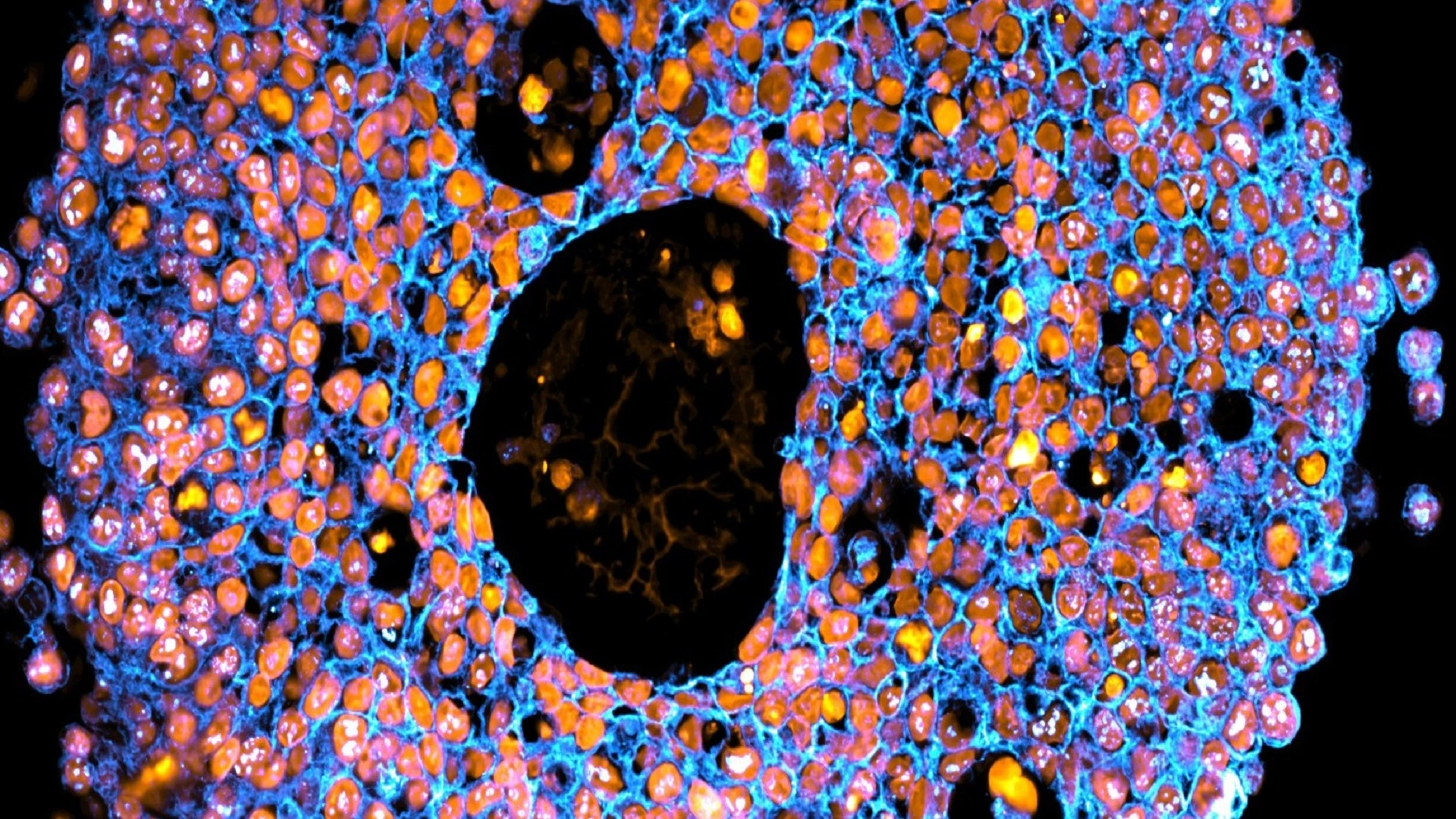 3D 列印胎盤模型助力安全的孕期藥物測試