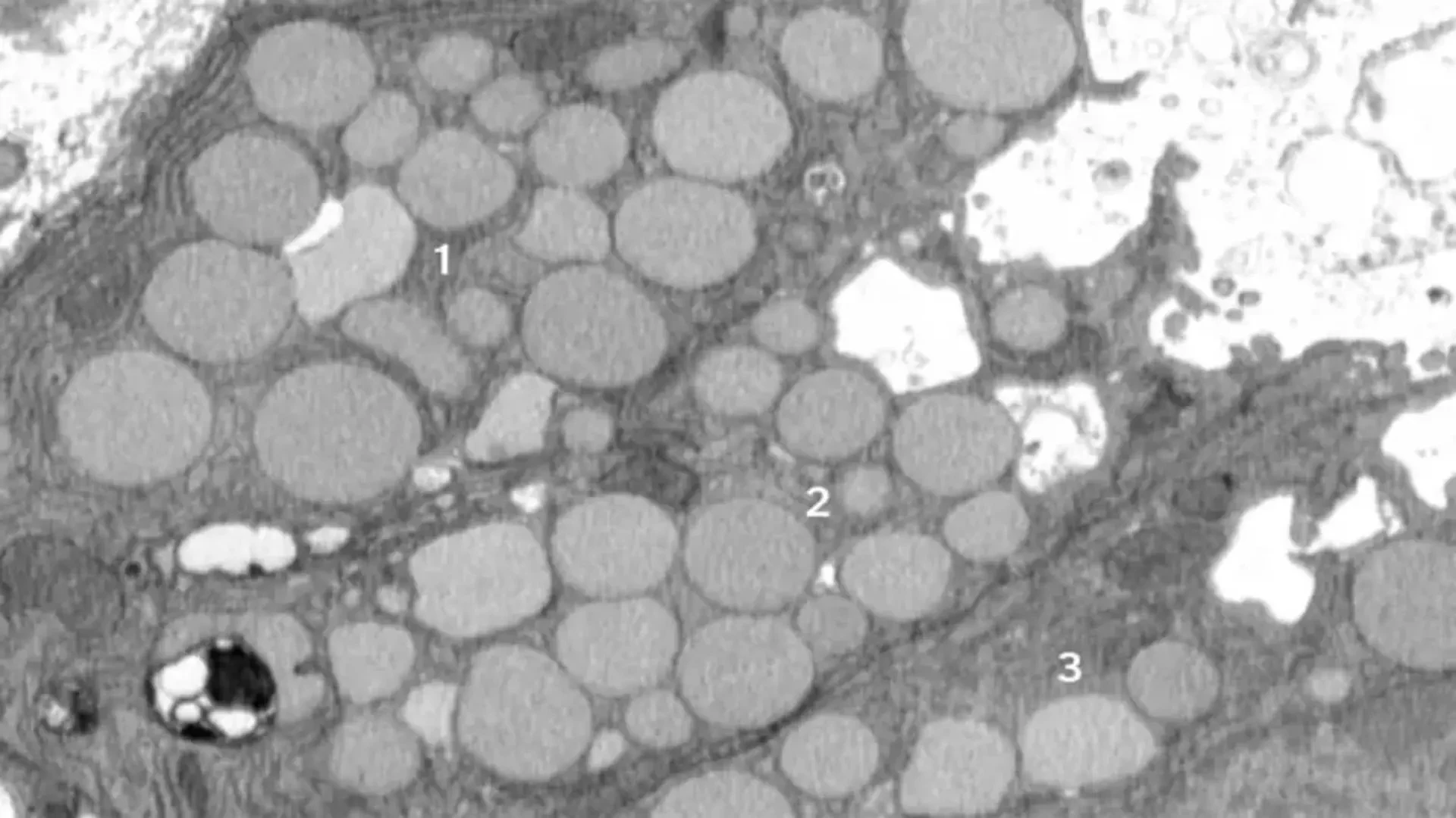 細胞排泄廢物以修復與回春，新研究顯示