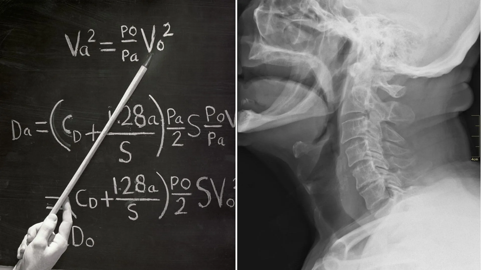 日本團隊利用數學模型解釋吞嚥困難問題