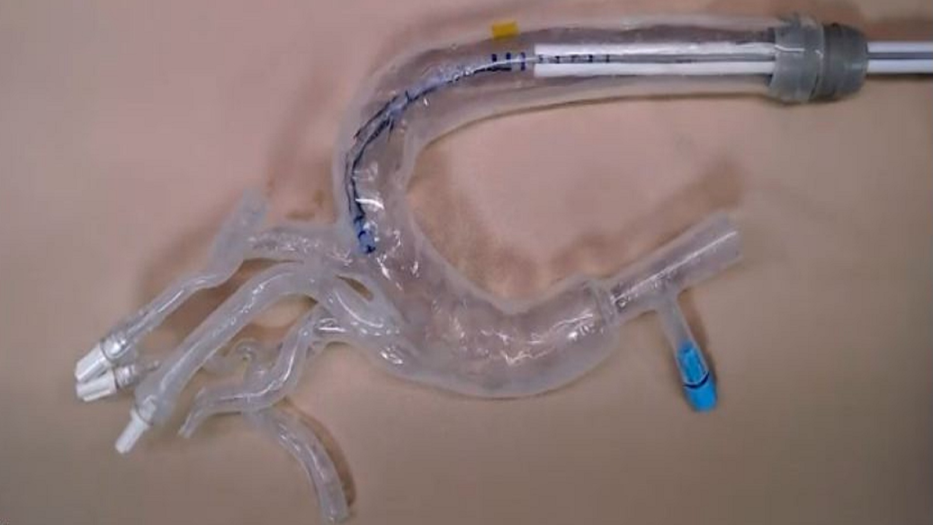 柔性機器人如藤蔓般在血管和噴氣引擎中生長