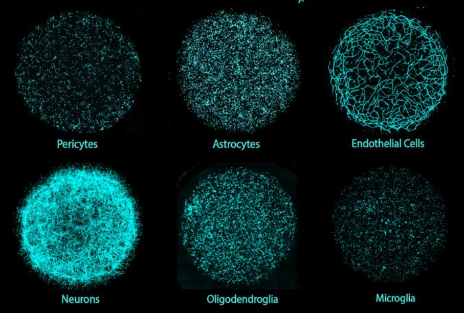 MIT 科學家研發 3D 人體腦組織模型 促進個性化療法發展