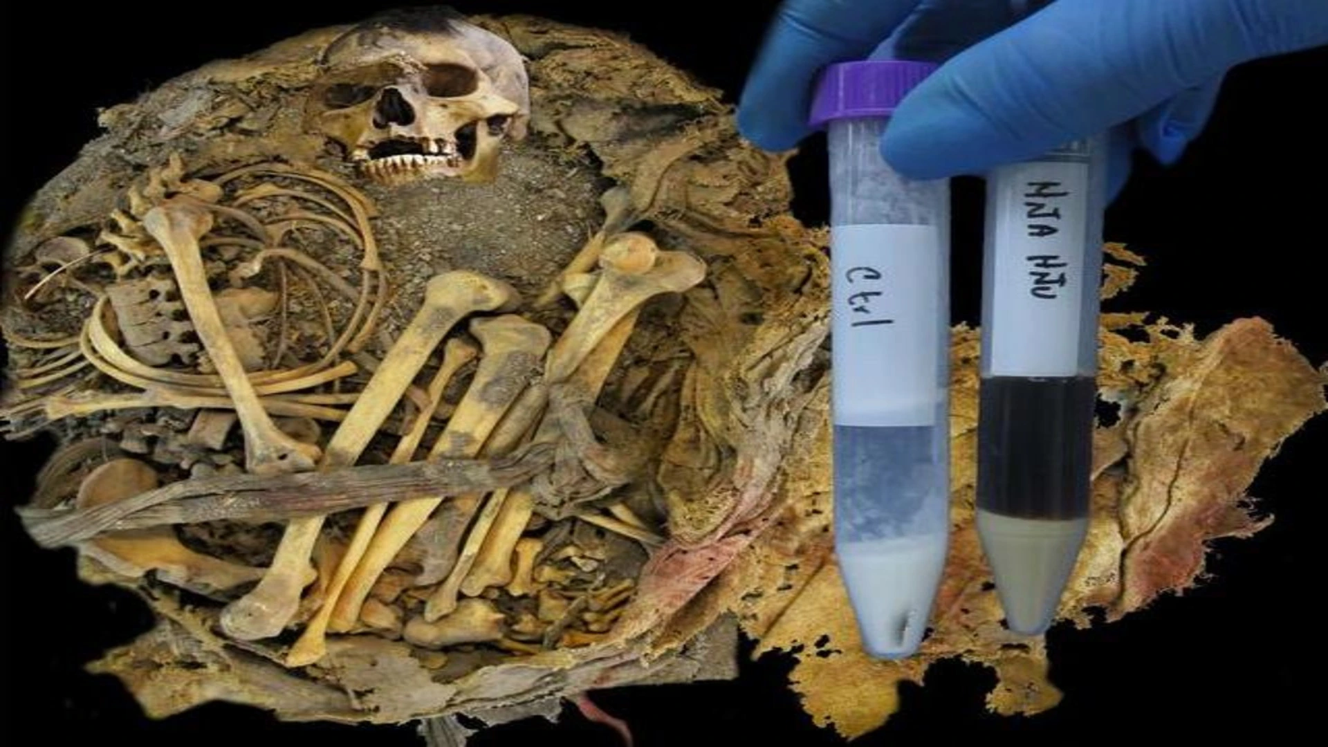 千年古人遺骸揭示微生物組特徵