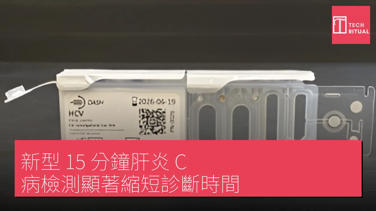 新型 15 分鐘肝炎 C 病檢測顯著縮短診斷時間
